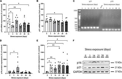 Abnormal expression of cortical cell cycle regulators underlying anxiety and depressive-like behavior in mice exposed to chronic stress